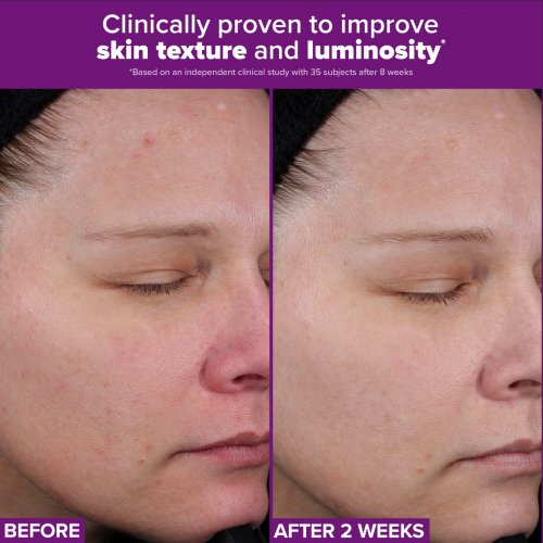 PRO Retinaldehyde Treatment 