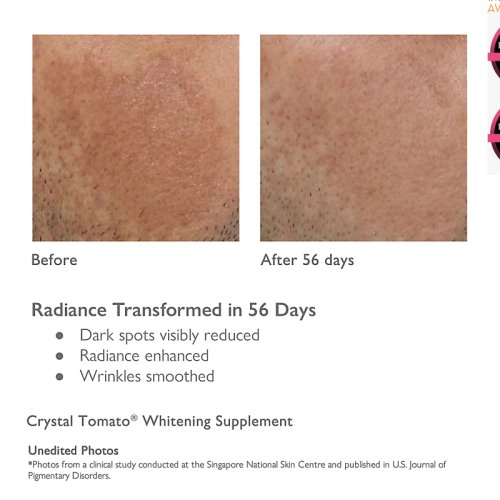 Crystal Tomato® Whitening Supplement